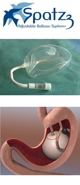 Bal&oacute;n Intrag&aacute;strico